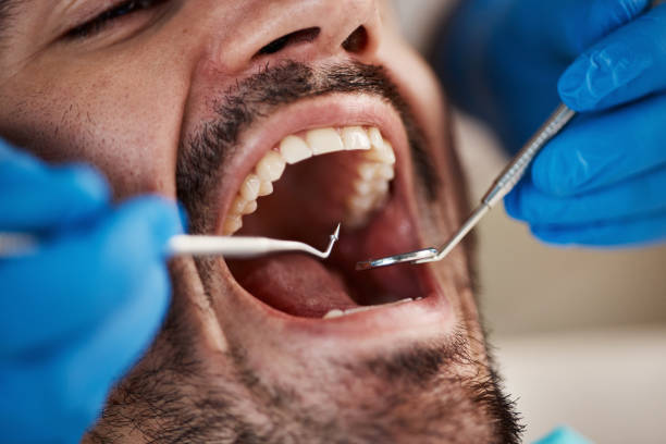 Best Emergency Dental Care for Broken or Chipped Teeth in Levittown, PA